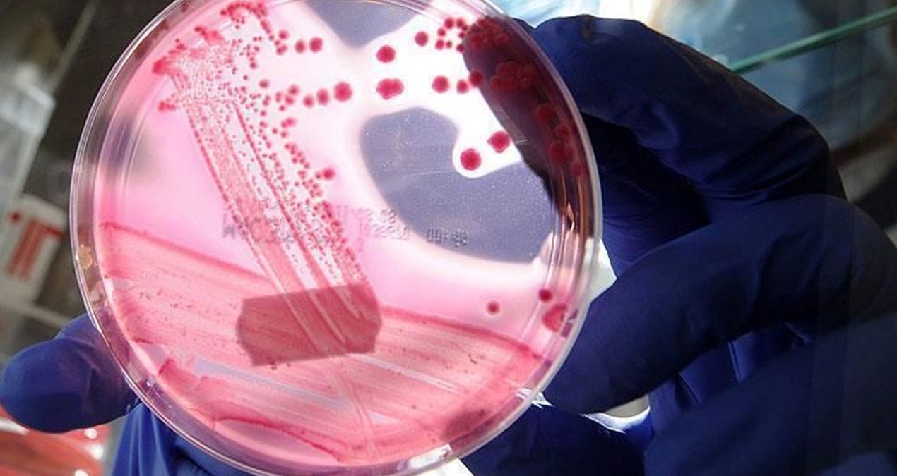 erkeklerde en cok gorulen ikinci kanser turu belli oldu zPKQren4