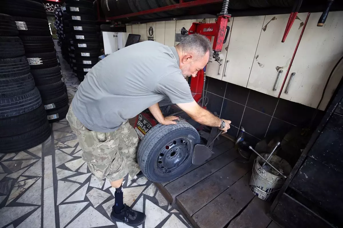 gazilikle hayata tutunan yuksel unal q38CAkeN