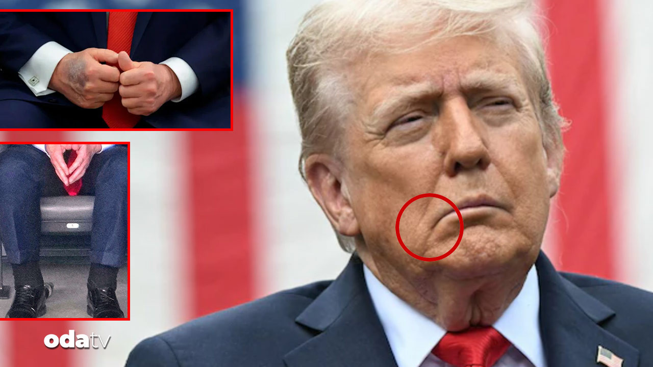 once elleri morardi sonra bilekleri sisti simdi de trumpin agzi yamuldu Ms7IlerN